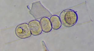 Sporocytes of Euduboscquella in Eutintinnus ciliate host
