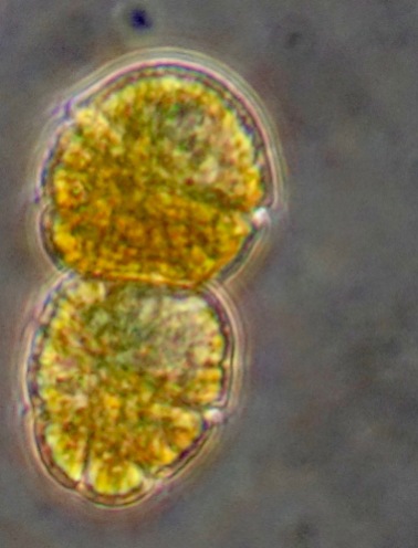 Cochlodinium sp. (dinoflagellate)